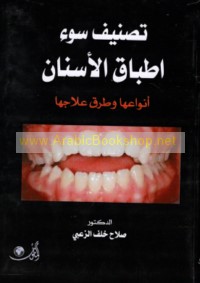 Taṣnīf sū’ iṭbāq al-asnān